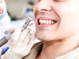 Why is regular professional dental cleaning mandatory?