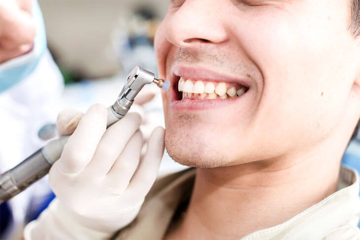 Why is regular professional dental cleaning mandatory?
