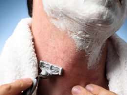 What You Need to Know About Treating Razor Bumps
